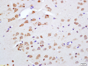 Phospho-NF2 (Ser518) Rabbit Polyclonal Antibody