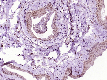 Phospho-NFKB p65 (Ser468) Rabbit Polyclonal Antibody