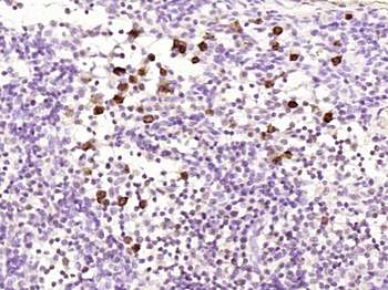 Phospho-NFKB p65 (Ser468) Rabbit Polyclonal Antibody