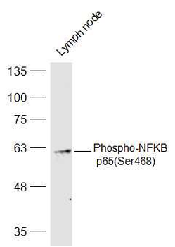 Phospho-NFKB p65 (Ser468) Rabbit Polyclonal Antibody