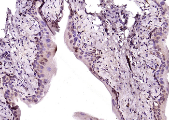 Phospho-NFKB p65 (Ser536) Rabbit Polyclonal Antibody