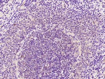 Phospho-NFKB p65 (Ser536) Rabbit Polyclonal Antibody