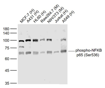 Phospho-NFKB p65 (Ser536) Rabbit Polyclonal Antibody