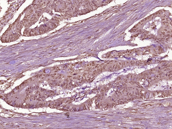 Phospho-NFKB p65 (Thr254) Rabbit Polyclonal Antibody