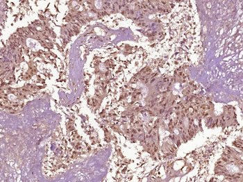 Phospho-NFKB p65 (Thr254) Rabbit Polyclonal Antibody