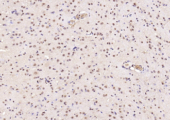 Phospho-NFKB1 (Ser893) Rabbit Polyclonal Antibody