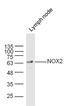 NOX2 Rabbit Polyclonal Antibody