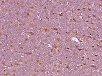 Phospho-NPM (Thr95) Rabbit Polyclonal Antibody