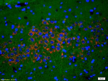Phospho-NMDAR1 (Ser890) Rabbit Polyclonal Antibody