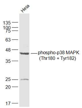 Phospho-p38 MAPK (Thr180 + Tyr182) Rabbit Polyclonal Antibody