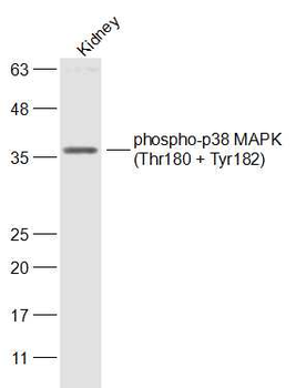 Phospho-p38 MAPK (Thr180 + Tyr182) Rabbit Polyclonal Antibody