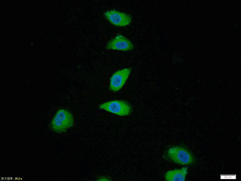 Phospho-p38 MAPK (Thr180 + Tyr182) Rabbit Polyclonal Antibody