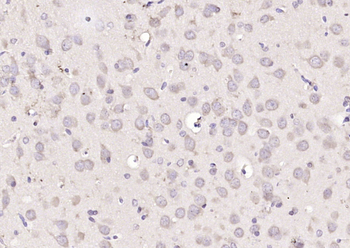 Phospho-MEK4 (Ser257) Rabbit Polyclonal Antibody
