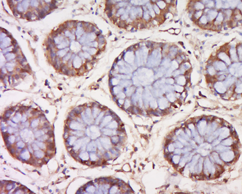 Phospho-MEK4 (Ser257 + Thr261) Rabbit Polyclonal Antibody