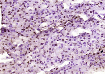 Phospho-P53 (Ser33) Rabbit Polyclonal Antibody