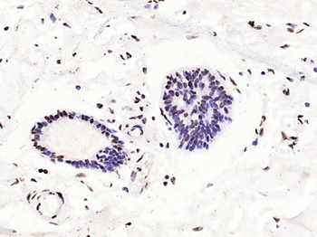 Phospho-P53 (Ser33) Rabbit Polyclonal Antibody
