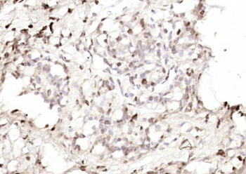 Phospho-P53 (Ser33) Rabbit Polyclonal Antibody