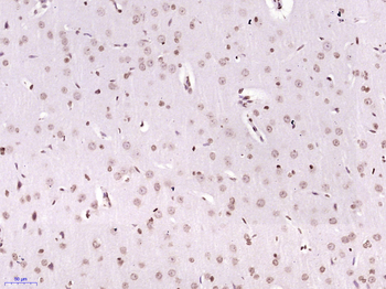 Phospho-p53BP1 (Ser25 + Ser29) Rabbit Polyclonal Antibody