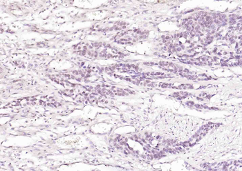 Phospho-p63 (Ser455) Rabbit Polyclonal Antibody