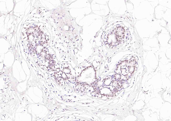 Phospho-p63 (Ser455) Rabbit Polyclonal Antibody