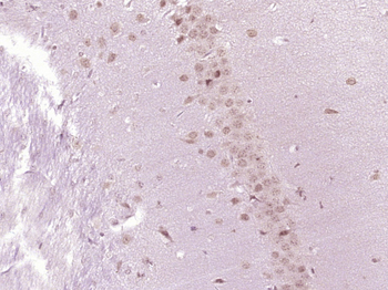 Phospho-RPS6KB1 (Ser434) Rabbit Polyclonal Antibody