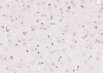 P70 S6 Kinase Beta Rabbit Polyclonal Antibody