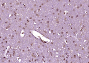 P70 S6 Kinase Beta Rabbit Polyclonal Antibody