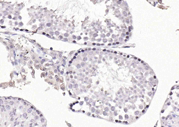 P70 S6 Kinase Beta Rabbit Polyclonal Antibody