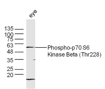Phospho-p70 S6 Kinase Beta (Thr228) Rabbit Polyclonal Antibody