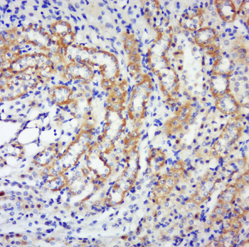 Phospho-p70 S6 Kinase Beta (Thr444 + Ser447) Rabbit Polyclonal Antibody