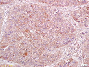 R-cadherin Rabbit Polyclonal Antibody