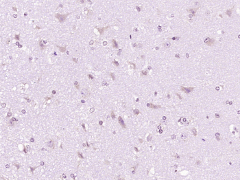 Phospho-PDGFRA (Tyr849)/ PDGFRB (Tyr857) Rabbit Polyclonal Antibody