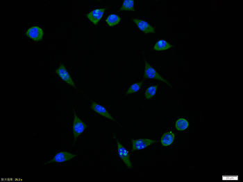 Phospho-PDGFRA (Tyr849)/ PDGFRB (Tyr857) Rabbit Polyclonal Antibody
