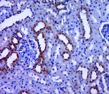 PDHB Rabbit Polyclonal Antibody