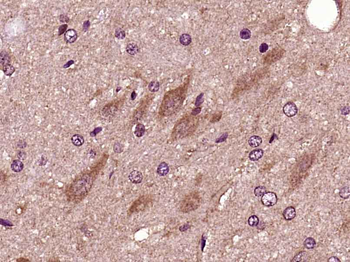 Phospho-PFKFB3/PFK2 (Ser467) Rabbit Polyclonal Antibody