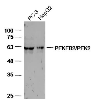 PFKFB2/PFK2 Rabbit Polyclonal Antibody