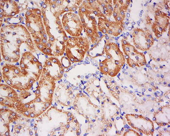 PFKFB2/PFK2 Rabbit Polyclonal Antibody