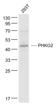 PHKG2 Rabbit Polyclonal Antibody