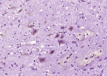 PKC gamma Rabbit Polyclonal Antibody