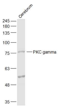 PKC gamma Rabbit Polyclonal Antibody