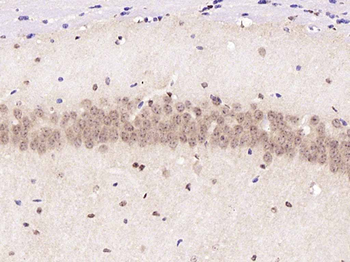 PKC delta Rabbit Polyclonal Antibody