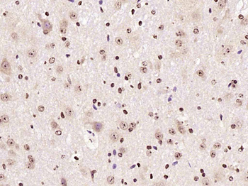 PKC delta Rabbit Polyclonal Antibody