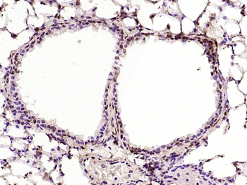 PKC delta Rabbit Polyclonal Antibody