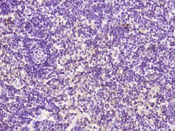 PKC delta Rabbit Polyclonal Antibody