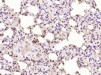 PKC delta Rabbit Polyclonal Antibody