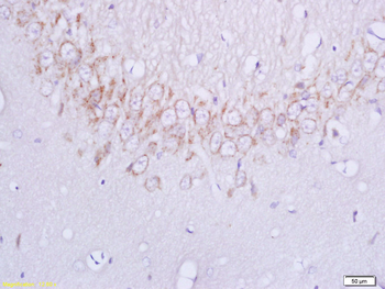 Plexin B1 Rabbit Polyclonal Antibody