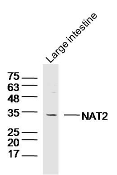 NAT2 Rabbit Polyclonal Antibody