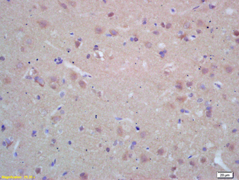 NAT2 Rabbit Polyclonal Antibody