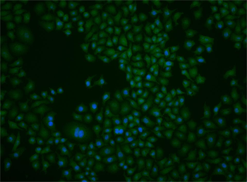 PP2CA Rabbit Polyclonal Antibody
