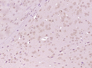 Phospho-AKT1 + AKT2 + AKT3 (Thr308+Thr309+Thr305) Rabbit Polyclonal Antibody